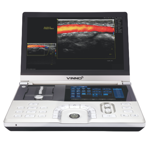 Ecografo portatil Vinno 5 Centro de Servicios Hospitalarios 3