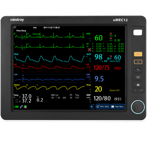Monitor multiparametrico Umec 12 Centro de Servicios Hospitalarios 2