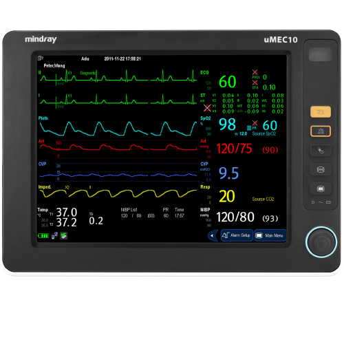 Monitor_multiparametrico_Mindray_Umec_10_Centro_de_Servicios_Hospitalarios-removebg-preview